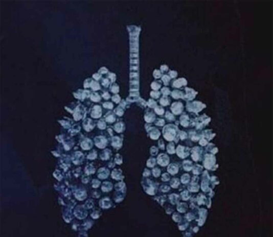 Stop Breathing - Roddy Ricch